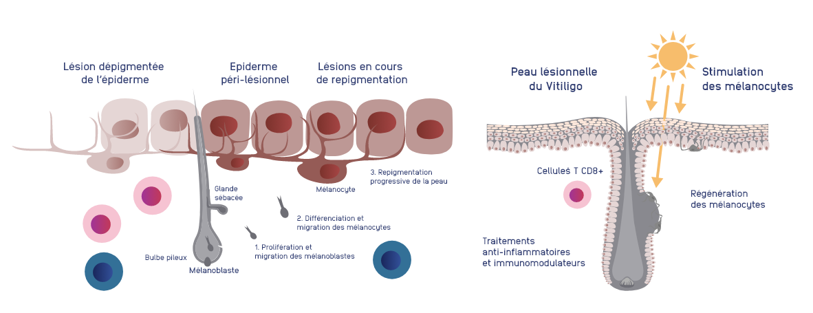 disease_management