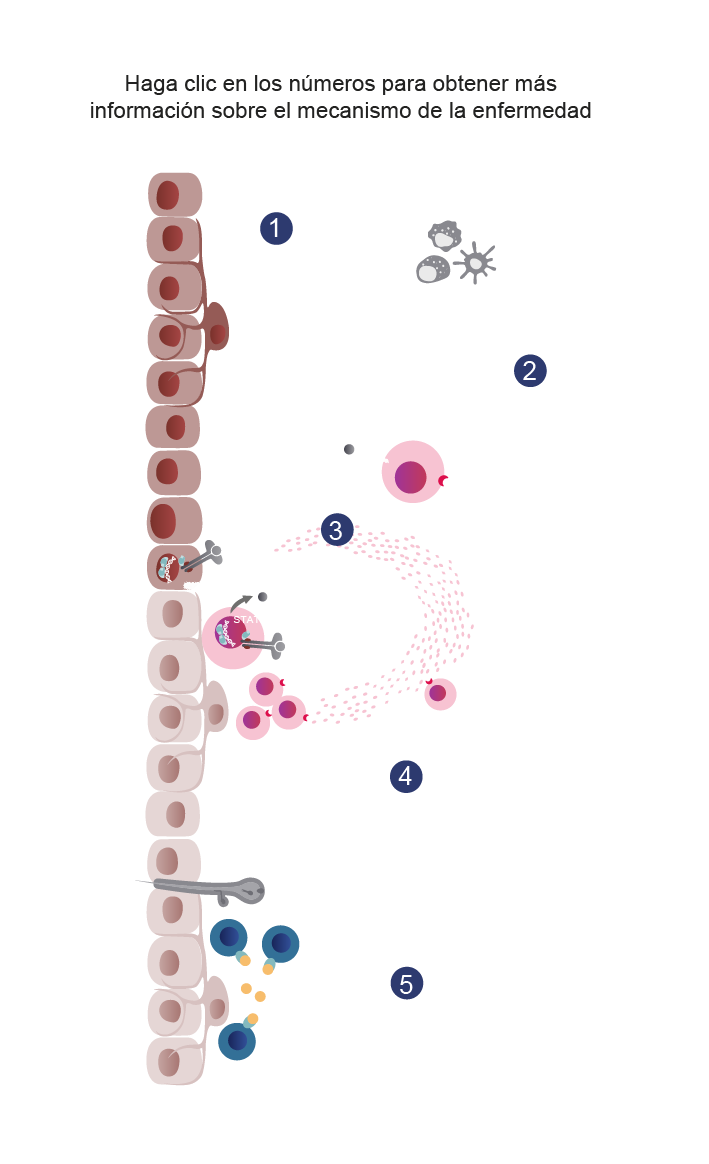 INT2106_Inctye_Vitiligo_Website_Graphics_R2V2-es-ES_Immunopathology_Mobile