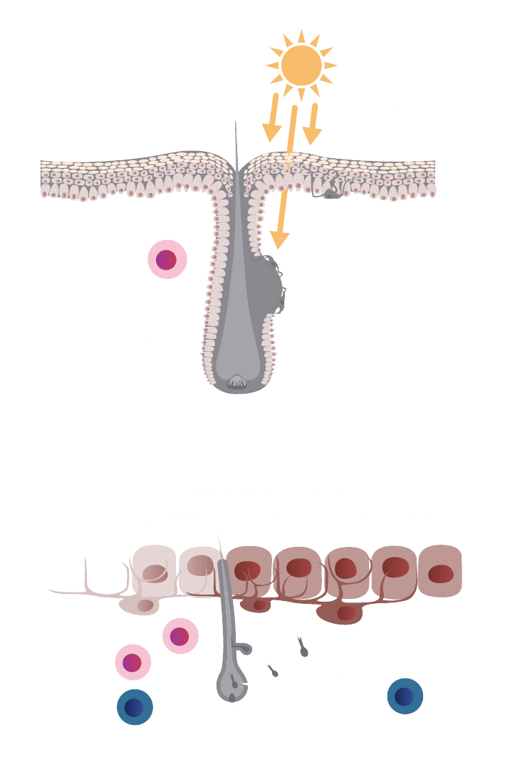 INT2106_Inctye_Vitiligo_Website_Graphics_R2V2-es-ES_Interventions_And_Repigmentation_Mobile