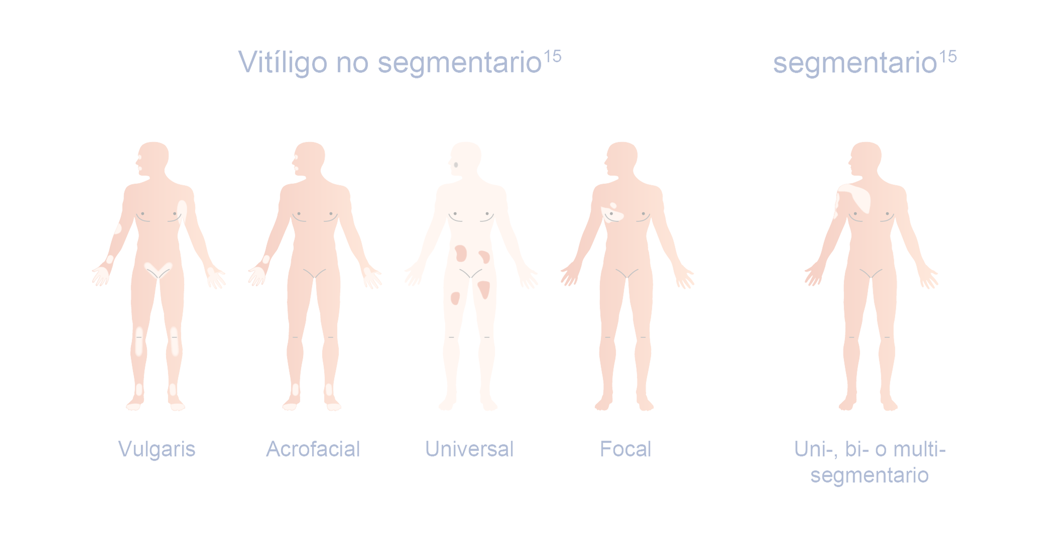 INT2106_Inctye_Vitiligo_Website_Graphics_R2V2-es-ES_Non-Segmental_Desktop 2